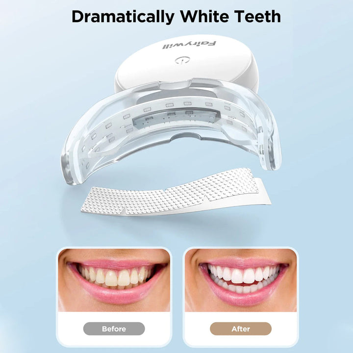 FAIRYWILL Rechargeable Teeth Whitening Kit with Teeth Whitening Strips